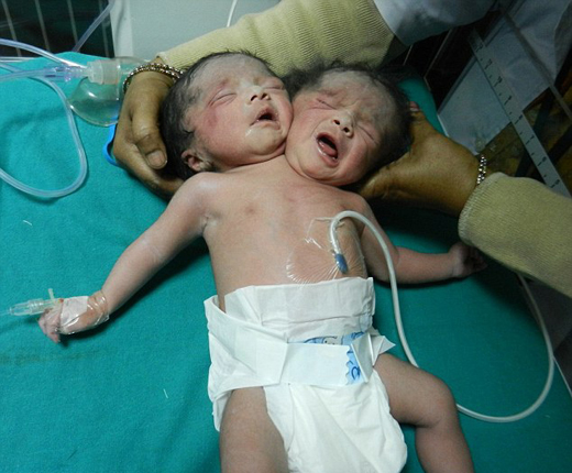 Baby-2 heads.